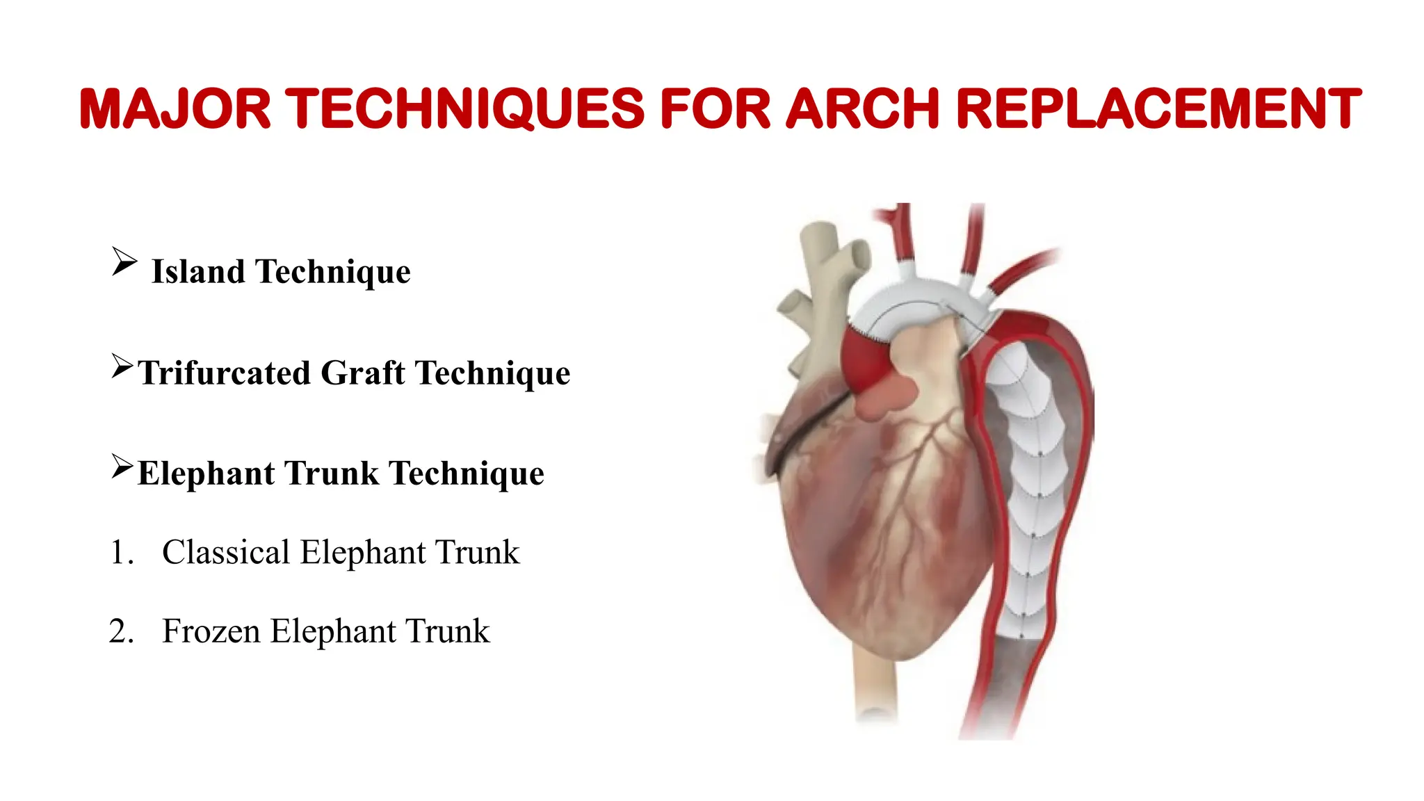 SURGICAL MANAGEMENT OF AORTIC ARCH PATHOLOGY | PPTX