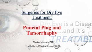 Surgeries for Dry Eye
Treatment:
Punctal Plug and
Tarsorrhaphy
Marjan Mazouchi MD,
Labbafinejad Medical Center, SBUM.
 