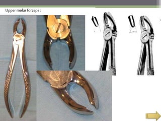 Upper molar forceps :
 