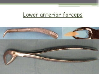 Lower anterior forceps
 