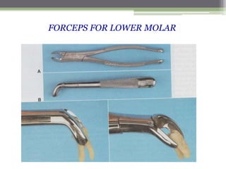 FORCEPS FOR LOWER MOLAR
 