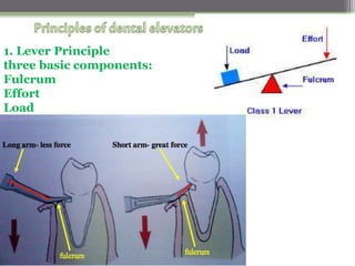 1. Lever Principle
three basic components:
Fulcrum
Effort
Load
 