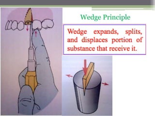 Wedge Principle
 