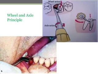 Wheel and Axle
Principle
 