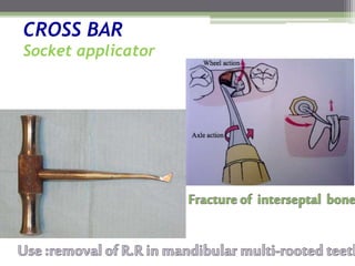CROSS BAR
Socket applicator
 
