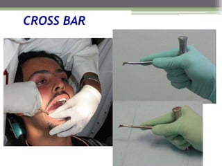 CROSS BAR
 