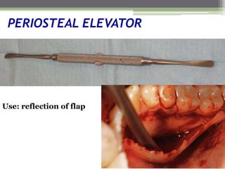 PERIOSTEAL ELEVATOR
Use: reflection of flap
 