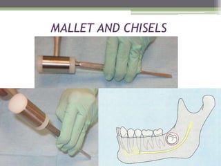 MALLET AND CHISELS
 