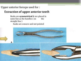 Upper anterior forceps used for :
Extraction of upper anterior teeth
Beaks are symmetrical & are placed in
thesame line as the handles ( on
straight line )
beaks are concave and not pointed
 