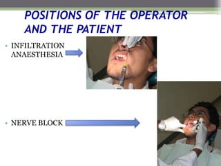 POSITIONS OF THE OPERATOR
AND THE PATIENT
• INFILTRATION
ANAESTHESIA
• NERVE BLOCK
 