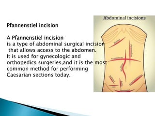 INTRODUCTION to Surgery | PPTX