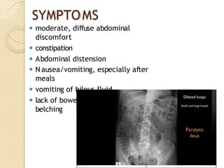 SYMPTOMS
⚫ moderate, diffuse abdominal
discomfort
⚫ constipation
⚫ Abdominal distension
⚫ Nausea/vomiting, especially after
meals
⚫ vomiting of bilous fluid
⚫ lack of bowel movement excessive
belching
 