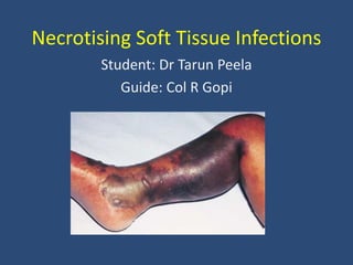 Necrotising Soft Tissue Infections
Student: Dr Tarun Peela
Guide: Col R Gopi
 