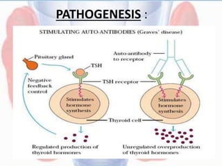 PATHOGENESIS :
 