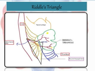 Riddle’s Triangle
 