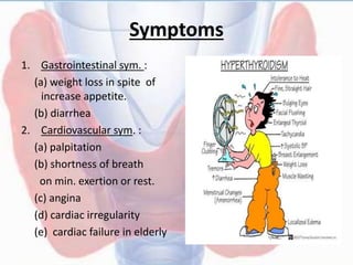 Symptoms
1. Gastrointestinal sym. :
(a) weight loss in spite of
increase appetite.
(b) diarrhea
2. Cardiovascular sym. :
(a) palpitation
(b) shortness of breath
on min. exertion or rest.
(c) angina
(d) cardiac irregularity
(e) cardiac failure in elderly
 