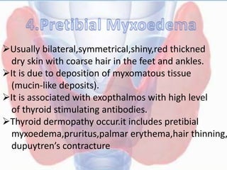 Usually bilateral,symmetrical,shiny,red thickned
dry skin with coarse hair in the feet and ankles.
It is due to deposition of myxomatous tissue
(mucin-like deposits).
It is associated with exopthalmos with high level
of thyroid stimulating antibodies.
Thyroid dermopathy occur.it includes pretibial
myxoedema,pruritus,palmar erythema,hair thinning,
dupuytren’s contracture
 