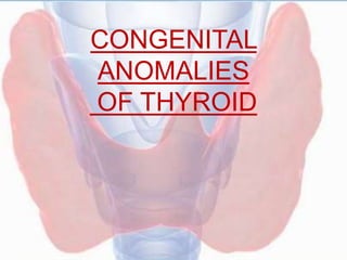 CONGENITAL
ANOMALIES
OF THYROID
 