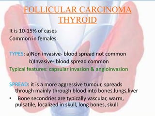 FOLLICULAR CARCINOMA
THYROID
It is 10-15% of cases
Common in females
TYPES: a)Non invasive- blood spread not common
b)Invasive- blood spread common
Typical features: capsular invasion & angioinvasion
SPREAD: it is a more aggressive tumour, spreads
through mainly through blood into bones,lungs,liver
• Bone secondries are typically vascular, warm,
pulsatile, localized in skull, long bones, skull
 