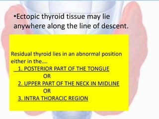 Residual thyroid lies in an abnormal position
either in the….
1. POSTERIOR PART OF THE TONGUE
OR
2. UPPER PART OF THE NECK IN MIDLINE
OR
3. INTRA THORACIC REGION
•Ectopic thyroid tissue may lie
anywhere along the line of descent.
 