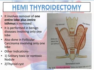 • It involves removal of one
entire lobe plus entire
isthmus is removed.
• It is performed in benign
diseases involving only one
lobe
• Also done in Follicular
Carcinoma involving only one
lobe
• Other Indications-
• 1) Solitary toxic or nontoxic
Nodule
• 2)Thyroid cyst
 