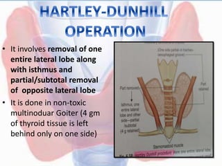 • It involves removal of one
entire lateral lobe along
with isthmus and
partial/subtotal removal
of opposite lateral lobe
• It is done in non-toxic
multinoduar Goiter (4 gm
of thyroid tissue is left
behind only on one side)
 