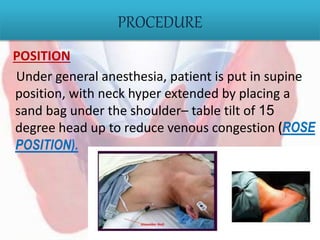 PROCEDURE
POSITION
Under general anesthesia, patient is put in supine
position, with neck hyper extended by placing a
sand bag under the shoulder– table tilt of 15
degree head up to reduce venous congestion (ROSE
POSITION).
 