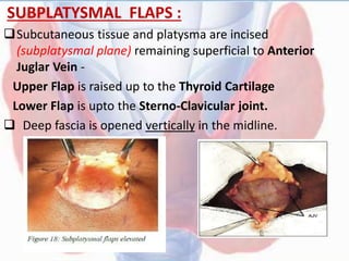 SUBPLATYSMAL FLAPS :
Subcutaneous tissue and platysma are incised
(subplatysmal plane) remaining superficial to Anterior
Juglar Vein -
Upper Flap is raised up to the Thyroid Cartilage
Lower Flap is upto the Sterno-Clavicular joint.
 Deep fascia is opened vertically in the midline.
 
