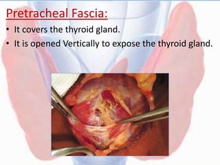Pretracheal Fascia:
• It covers the thyroid gland.
• It is opened Vertically to expose the thyroid gland.
 