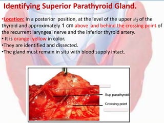 Identifying Superior Parathyroid Gland.
•Location: In a posterior position, at the level of the upper 2/3 of the
thyroid and approximately 1 cm above and behind the crossing point of
the recurrent laryngeal nerve and the inferior thyroid artery.
• It is orange- yellow in color.
•They are identified and dissected.
•The gland must remain in situ with blood supply intact.
 