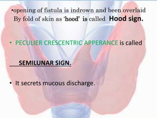 •opening of fistula is indrown and been overlaid
By fold of skin as ‘hood’ is called Hood sign.
• PECULIER CRESCENTRIC APPERANCE is called
SEMILUNAR SIGN.
• It secrets mucous discharge.
 