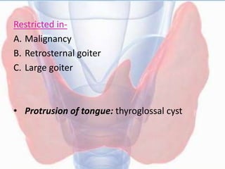 Restricted in-
A. Malignancy
B. Retrosternal goiter
C. Large goiter
• Protrusion of tongue: thyroglossal cyst
 