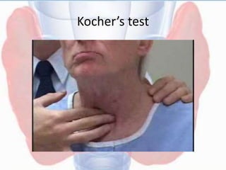 Kocher’s test
 