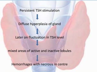 Persistent TSH stimulation
Diffuse hyperplasia of gland
Later on fluctuation in TSH level
mixed areas of active and inactive lobules
Hemorrhages with necrosis in centre
 