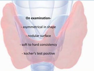 On examination-
- asymmetrical in shape
- nodular surface
- soft to hard consistency
- kocher’s test positive
 