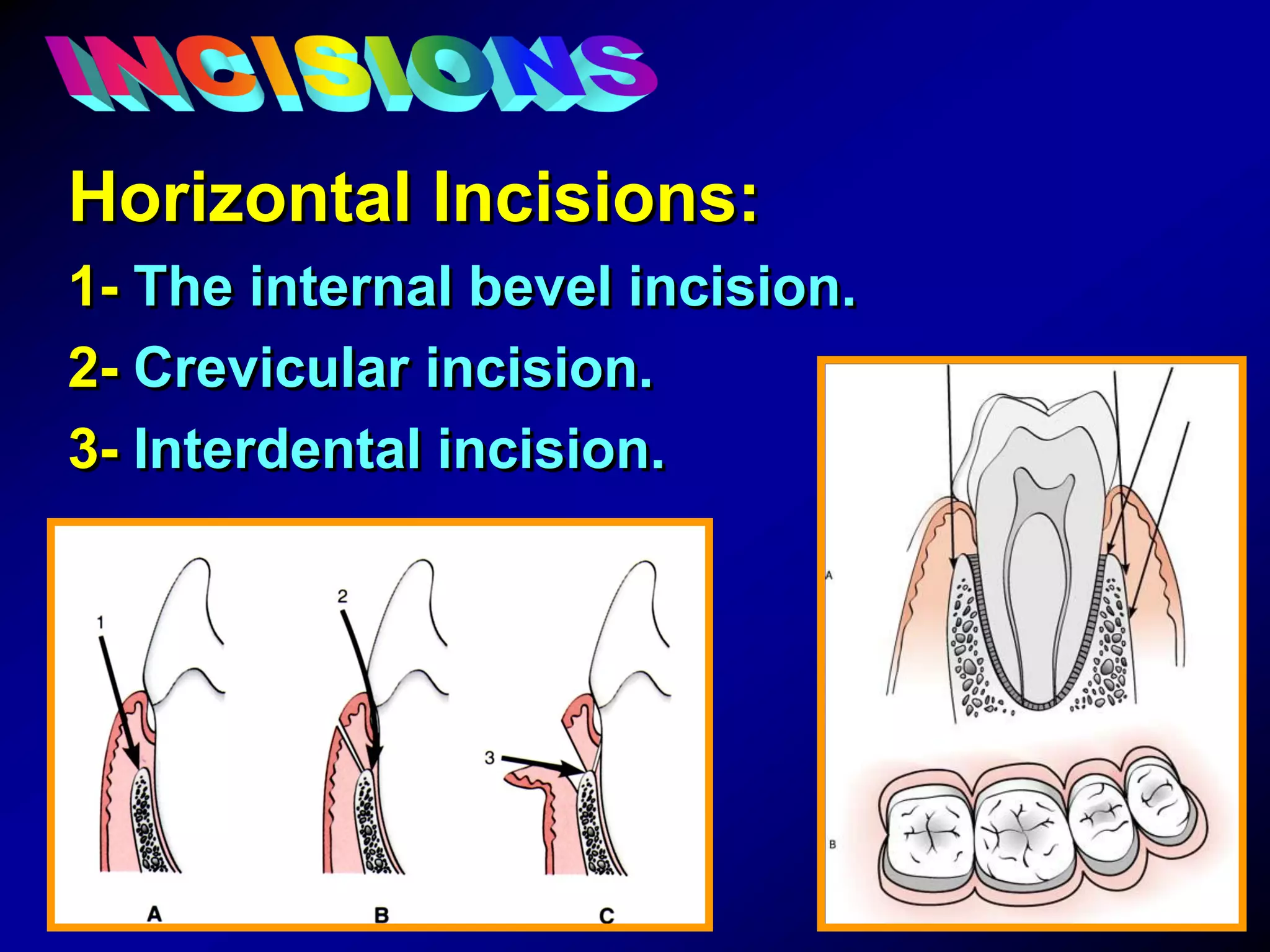 General Principles of Surgical Techniques for Periodontal Regeneration ...