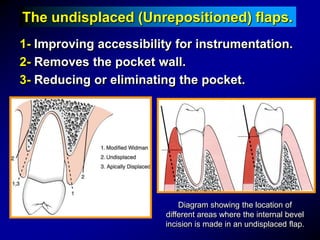 General Principles of Surgical Techniques for Periodontal Regeneration ...