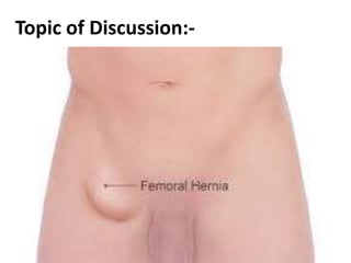 Topic of Discussion:-
 