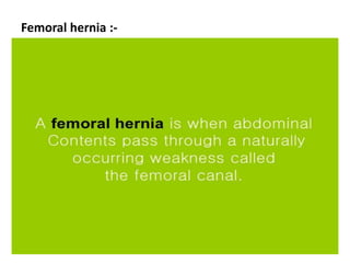 Femoral hernia :-
 