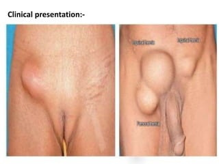 Clinical presentation:-
 