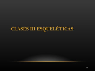 13
CLASES III ESQUELÉTICAS
 