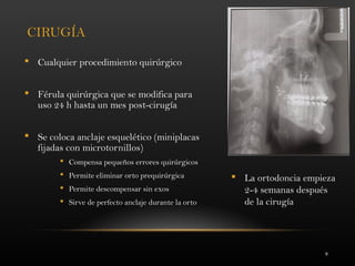 9
CIRUGÍA
 Cualquier procedimiento quirúrgico
 Férula quirúrgica que se modifica para
uso 24 h hasta un mes post-cirugía
 Se coloca anclaje esquelético (miniplacas
fijadas con microtornillos)
 Compensa pequeños errores quirúrgicos
 Permite eliminar orto prequirúrgica
 Permite descompensar sin exos
 Sirve de perfecto anclaje durante la orto
 La ortodoncia empieza
2-4 semanas después
de la cirugía
 