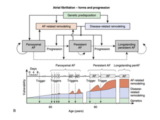 Surgery for atrial fibrillation abhijit presentation | PDF