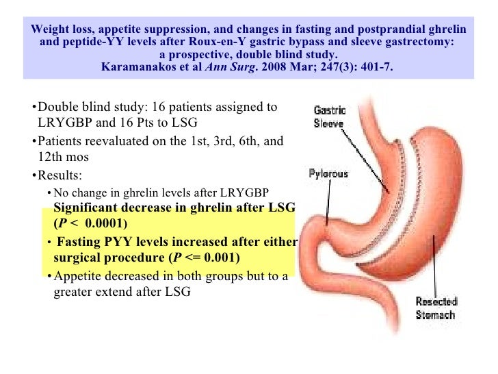 Ghrelin and gastric bypass surgery