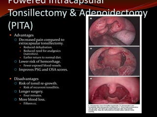 Powered Intracapsular
Tonsillectomy & Adenoidectomy
(PITA)
 Advantages
 Decreased pain compared to
extracapsular tonsillectomy.
 Reduced dehydration.
 Reduced need for analgesics
(narcotics).
 Earlier return to normal diet.
 Lower risk of hemorrhage.
 Fewer exposed blood vessels.
 Improves PSG and OSA scores.
 Disadvantages
 Risk of tonsil re-growth.
 Risk of recurrent tonsillitis.
 Longer surgery.
 Four minutes.
 More blood loss.
 Fifteen cc.
 