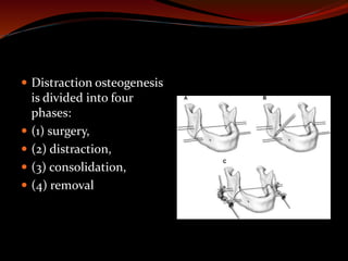  Distraction osteogenesis
is divided into four
phases:
 (1) surgery,
 (2) distraction,
 (3) consolidation,
 (4) removal
 