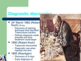 Diagnostic discoveries 
 24th March 1882 (Robert 
Koch) TB Day 
– Discovery of staining 
technique that identified 
Tuberculosis bacillus 
– Definite diagnosis made 
possible and thus 
treatment could begin 
 1890 (Robert Koch) 
– Tuberculin discovered 
– Diagnostic use when 
injected into skin 
 1895 (Roentgen) 
– Discovery of X-rays 
– Early diagnosis of 
pulmonary disease 
5 
 