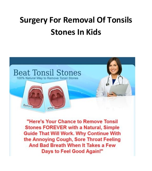 Surgery for removal of tonsils stones in kids