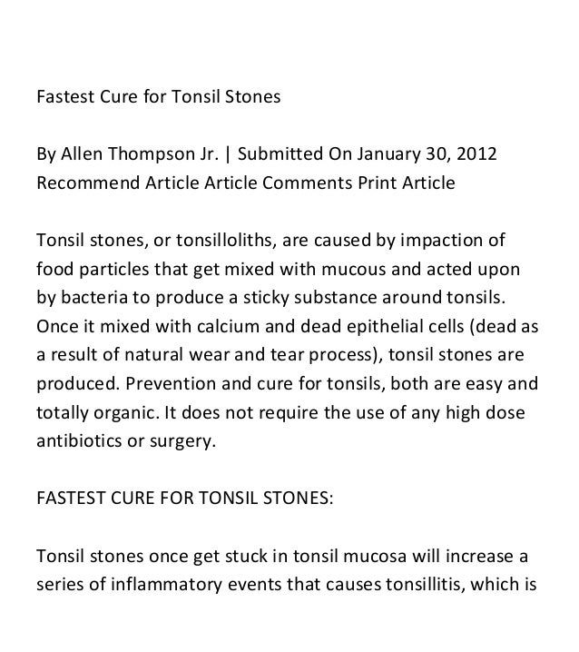 Surgery for removal of tonsils stones in kids