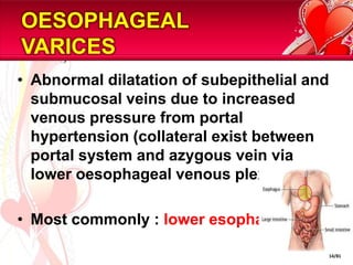 OESOPHAGEAL VARICESAbnormal dilatation of subepithelial and submucosal veins due to increased venous pressure from portal hypertension (collateral exist between portal system and azygous vein via lower oesophageal venous plexus).Most commonly : lower esophagus.14/81